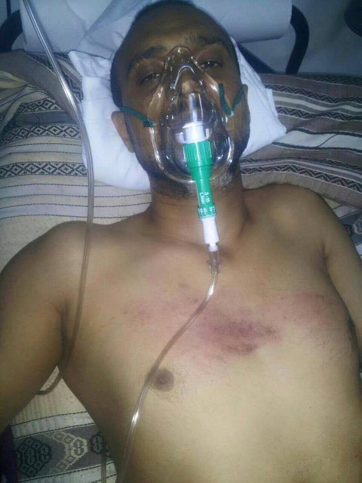 الناشط الهمداني بعد أسبوعين من الاختطاف والتعذيب بسجون الحوثي 